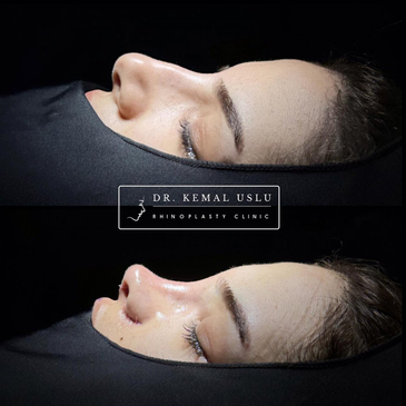 Slider image (3) Dr. Kemal Uslu Clinic